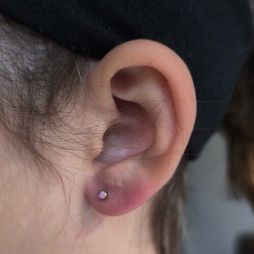 Percer les Lobes des Enfants ?